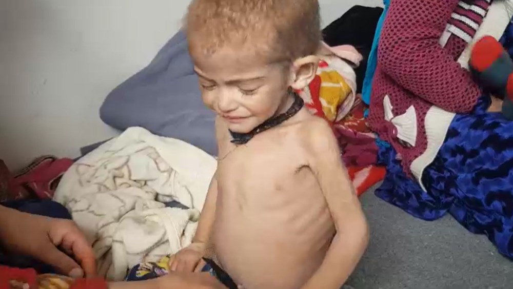 Afganistan'daki açlık krizinin acı yüzü: 3 yaşında ama bir bebek kadar küçük - 2