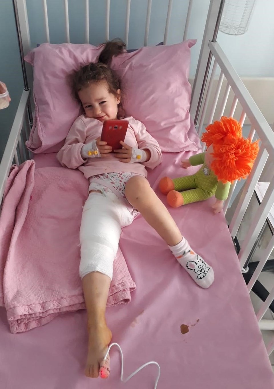 Ankara'da 2,5 yaşındaki kıza pitbull saldırdı - 1