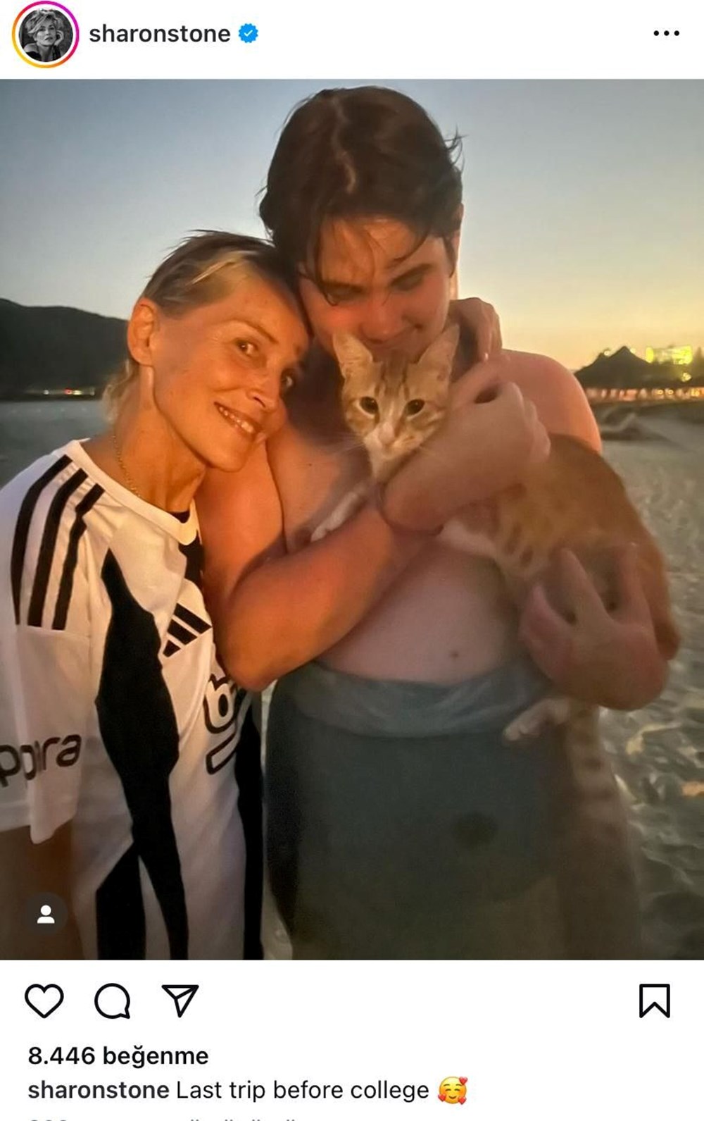 Ünlü oyuncu Sharon Stone'un gözüne ne oldu? - 5