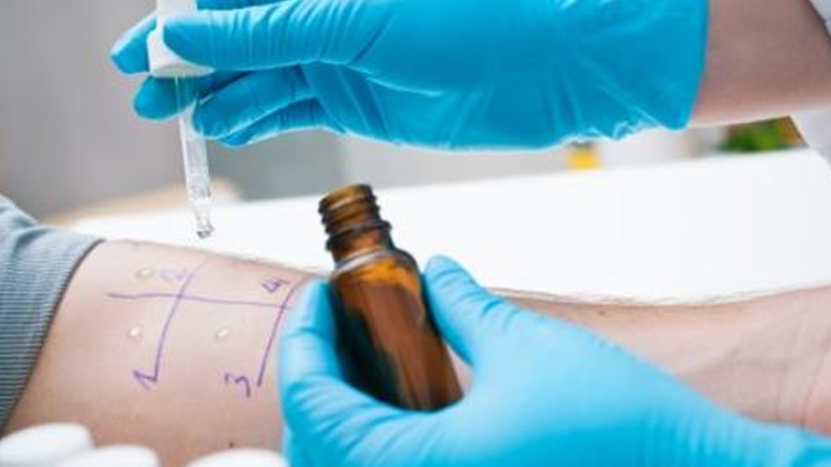 Alerji Nasil Anlasilir Penisilin Alerjisi Oldugu Bildirilen 10 Hastadan 9 Unda Alerji Yok Saglik Haberleri Ntv