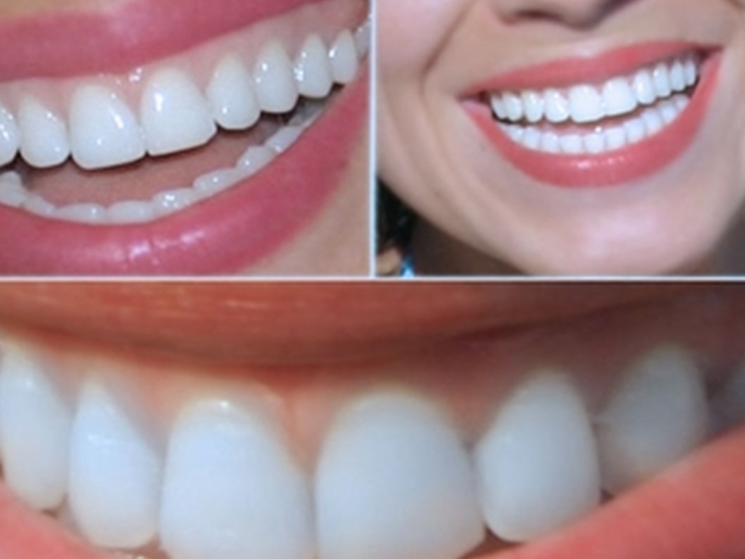 Hamilelikte Dis Curukleri Artar Mi Saglik Haberleri Ntv