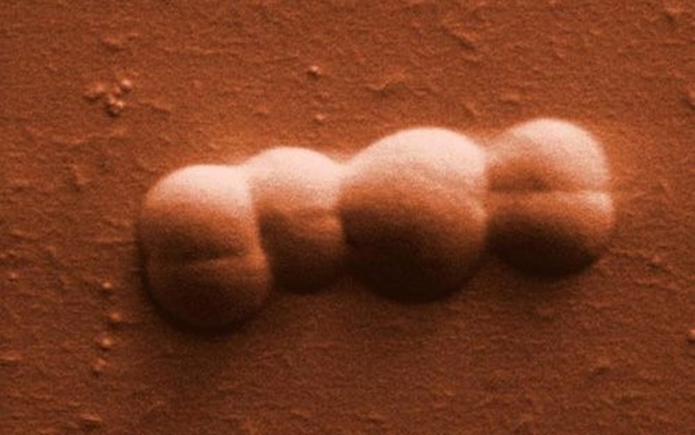 Mars'ta hayat var mı? (Yeni araştırma: Yaşam kanıtları yüzeyin altında gömülü) - 10