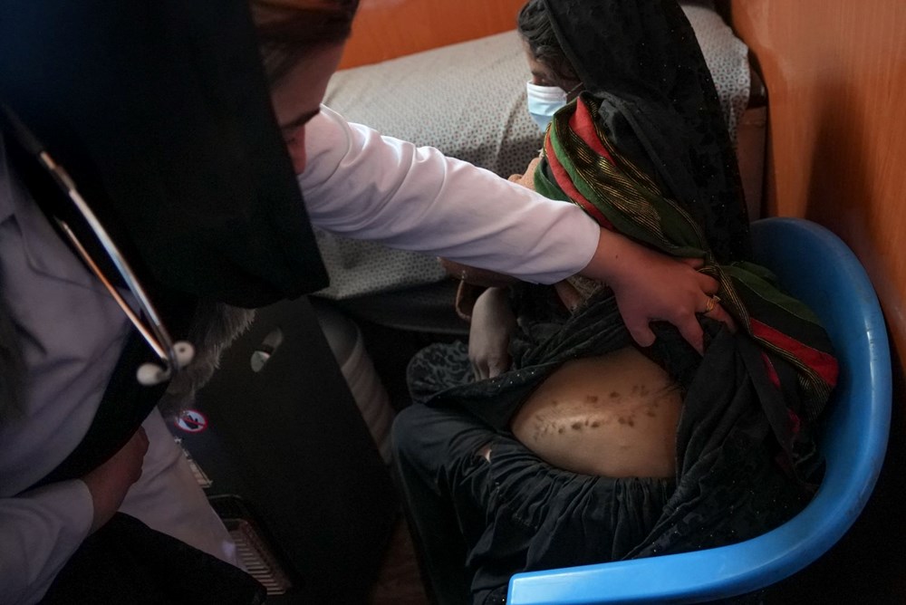 Afganistan'ın organ pazarı haline gelen kenar mahalleleri: 6 ve 8 yaşındaki iki kızımın ardından böbreğimi sattım - 18
