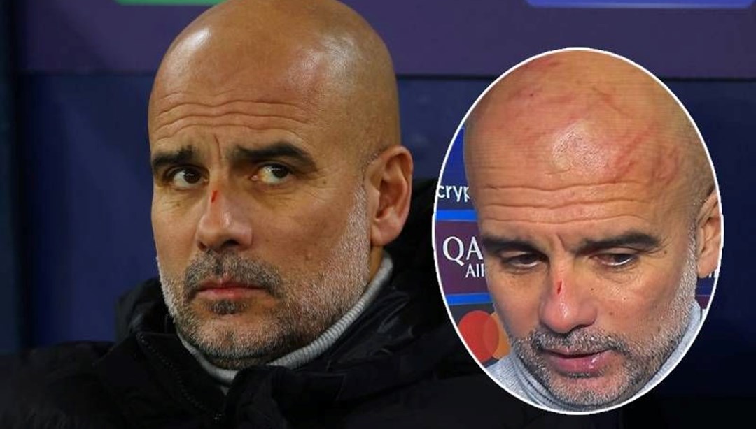 6 maçtır kazanamayan Manchester City'de Guardiola'nın yüzündeki çizikler dikkat çekti: Kendime zarar vermek istedim