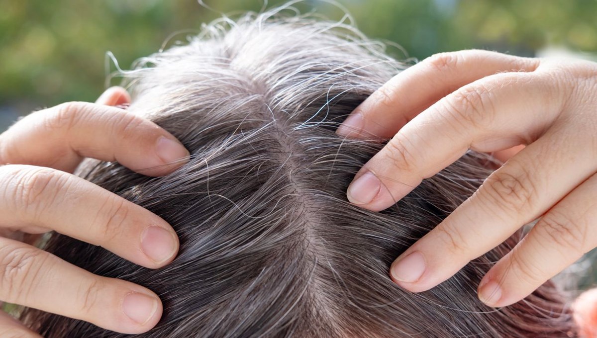 Beyaz saçların nedeni buymuş: Hangi hastalıkların habercisi?
