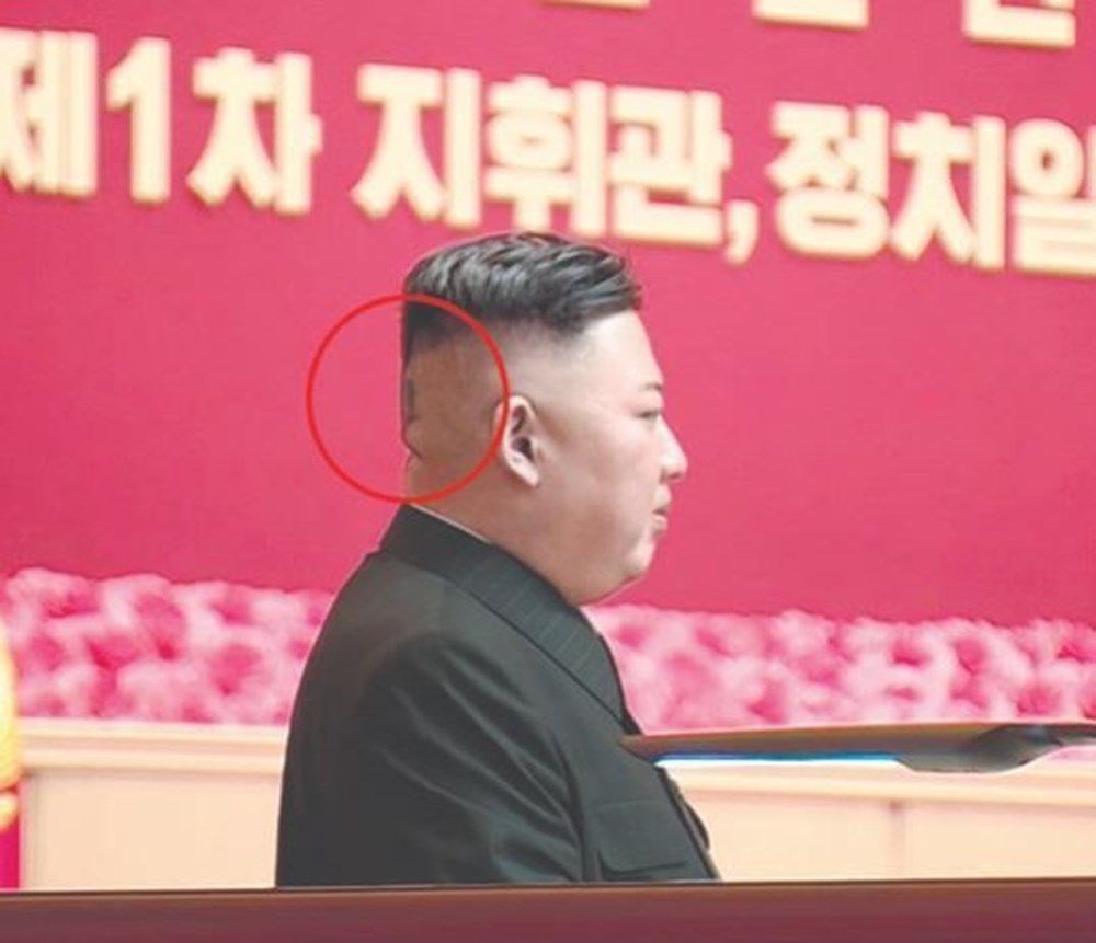 Kim Jong-Un zayıfladı, boynu ortaya çıktı - 6