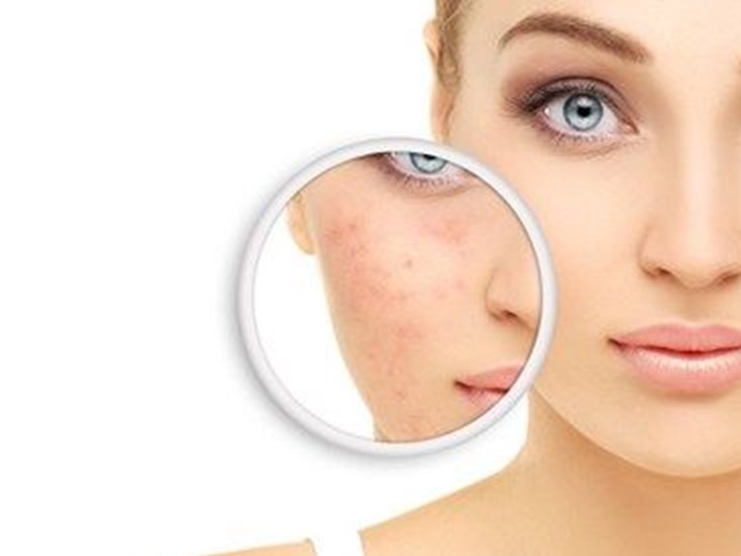 gul hastaligi neden olur haberleri