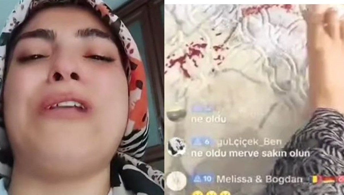 Çocuğu yaralıyken dakikalarca canlı yayın yapmıştı: TikTok‘ta Çocuğu yaralıyken dakikalarca canlı yayın yapmıştı: TikTok‘ta